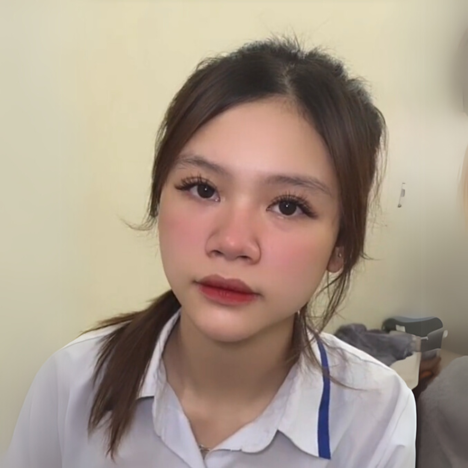 nối mi 